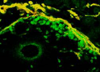 Fig.3：マウス胎仔の腸間膜リンパ節原基を特異抗体A7Rで染色（蛍光緑、写真中央）、中央左下方に腸間膜動脈をみとめる。